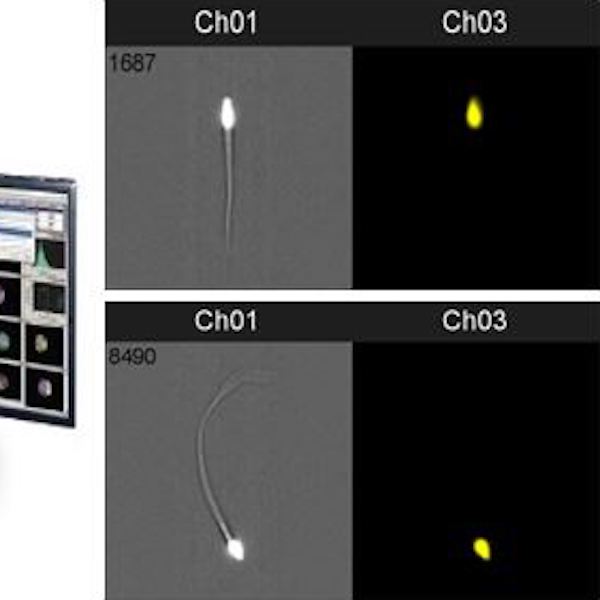 Improving Methods to Isolate Rare Sperm