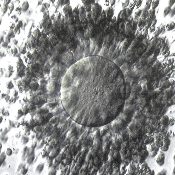 The Impact That Ovarian Stimulation and Trigger Protocols Have on the Supporting Cells of the Follicle