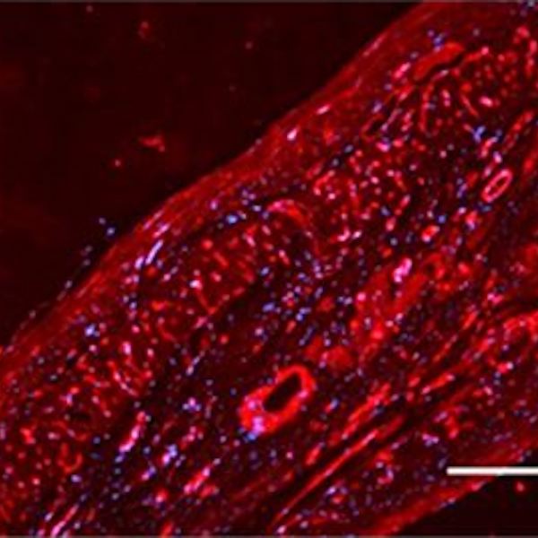 Cardiovascular Regeneration Research